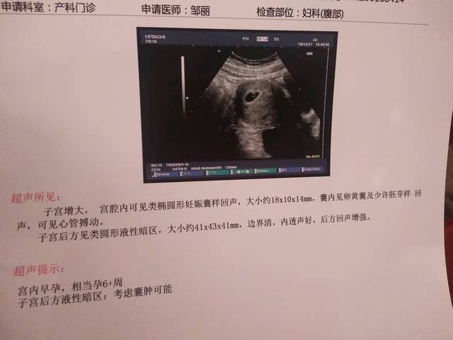 供卵试管婴儿第三次B超检查是什么样子的-供卵试管婴儿移植第三次B超要检查什么？
