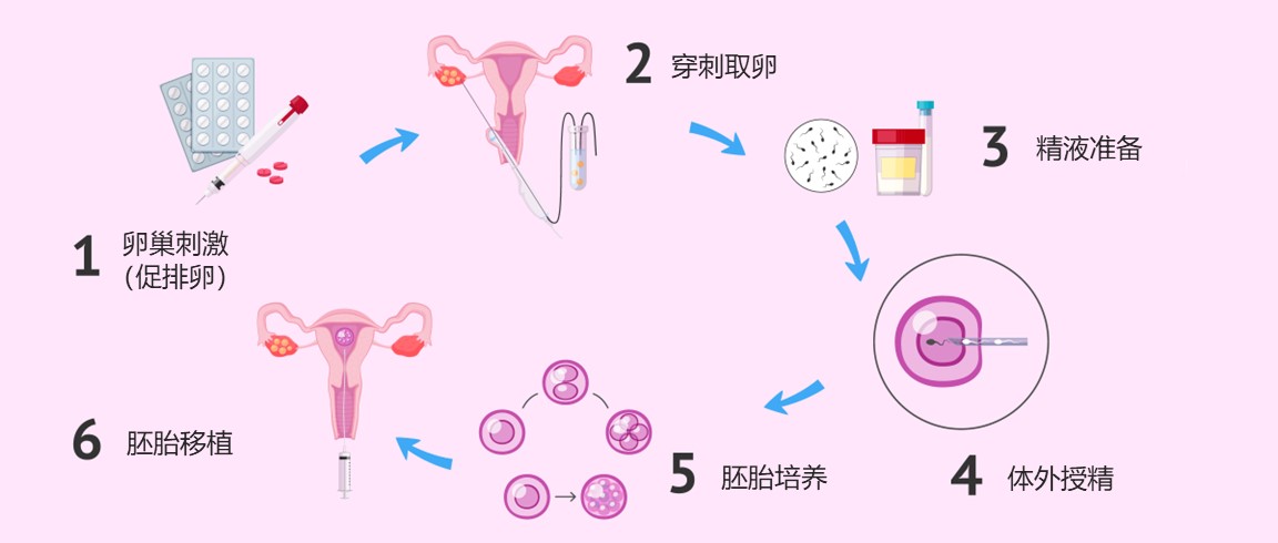 多胎妊娠会带来哪些风险去哪里发试管代怀信息多胎必须要减胎？